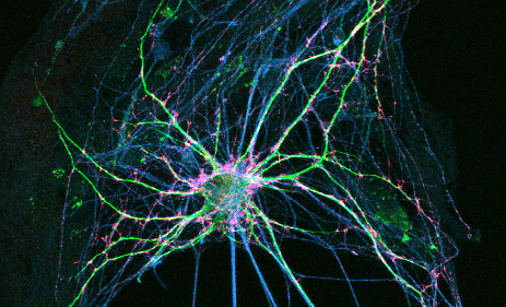Deciphering the developing brain - VU:Sci Magazine